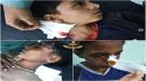 الضالع : أصابة 3 أطفال بانفجار مقذوف حوثي 